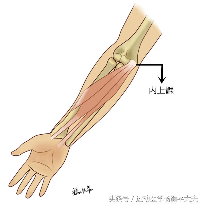 不打高尔夫反而得了高尔夫球肘？